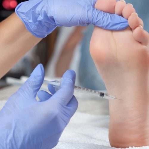 botox injection for sweaty foot queens ny